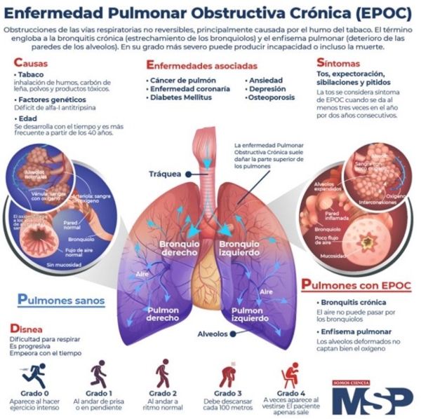 Infografía Enfermedad Obstructiva Crónica. 