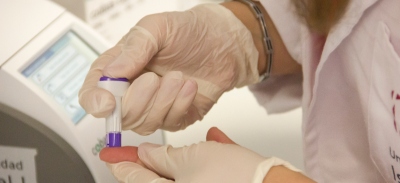 Médico toma muestras de sangre