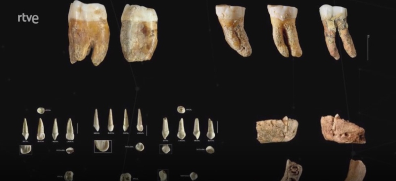Restos de dientes del yacimiento de Pinilla del Valle en el programa Arqueomanía