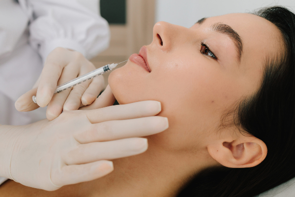 Inyección de ácido hialurónico en el rostro, una técnica utilizada en medicina estética para mejorar la tersura de la piel.