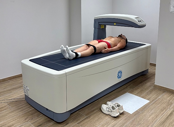 dexa