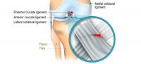 ligamento cruzado anterior